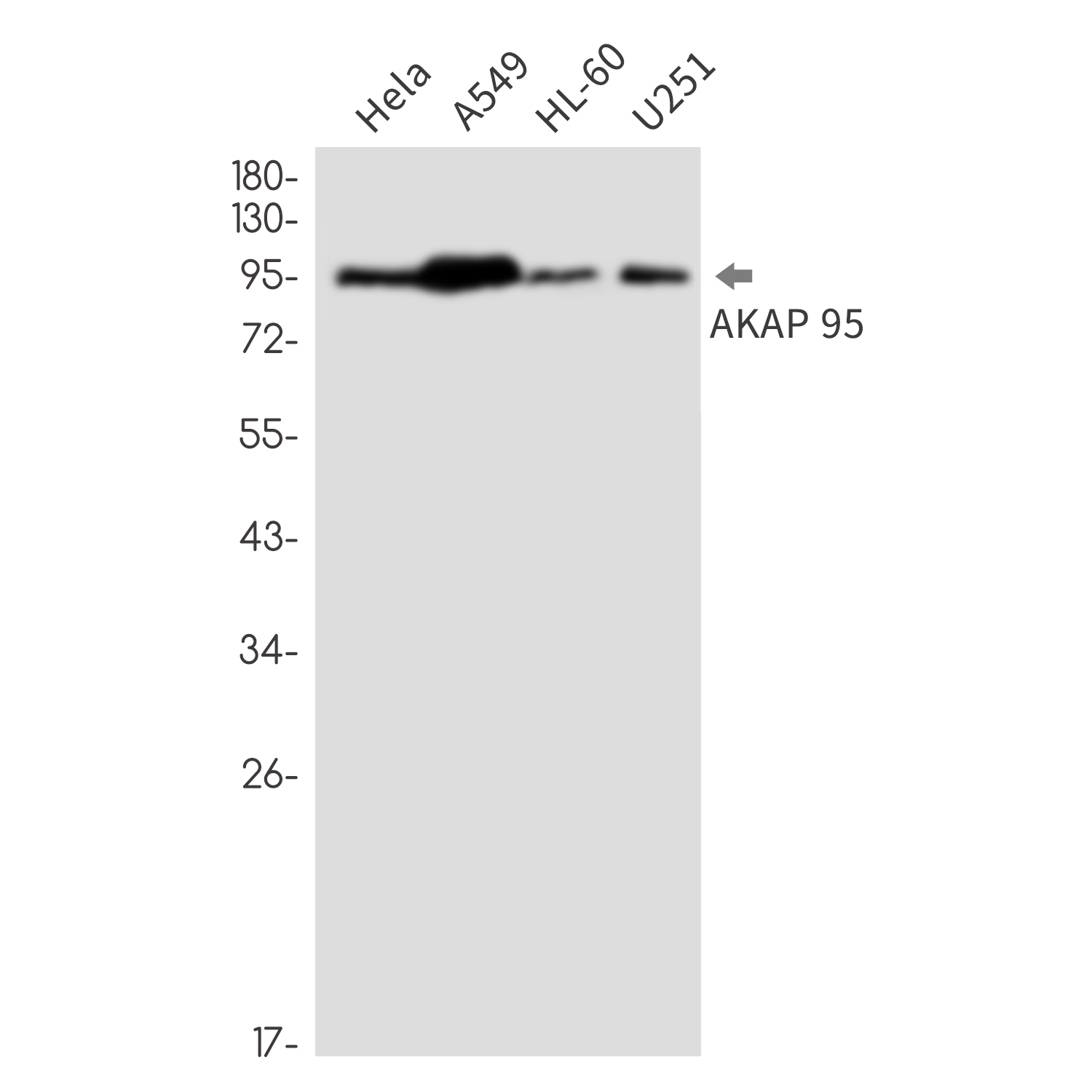 AKAP95 Rabbit mAb